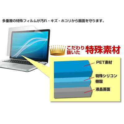 楽天市場 メディアフューチャー 反射防止フィルム タブレットpcケース キーボードカバー Nec Lavie Note Mobile Nm550 Ka 価格比較 商品価格ナビ 楽天市場 メディアフューチャー 反射防止フィルム タブレットpcケース キーボードカバー Nec Lavie Note Mobile Nm550 Ka 価格比較 商品価格ナビ